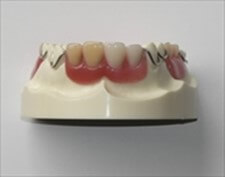 プラスチック義歯（保険適用）2